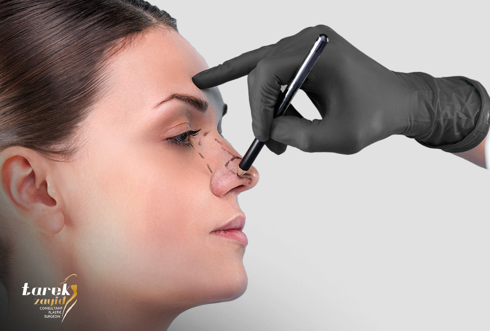 Conditions-That-May-Require-Rhinoplasty