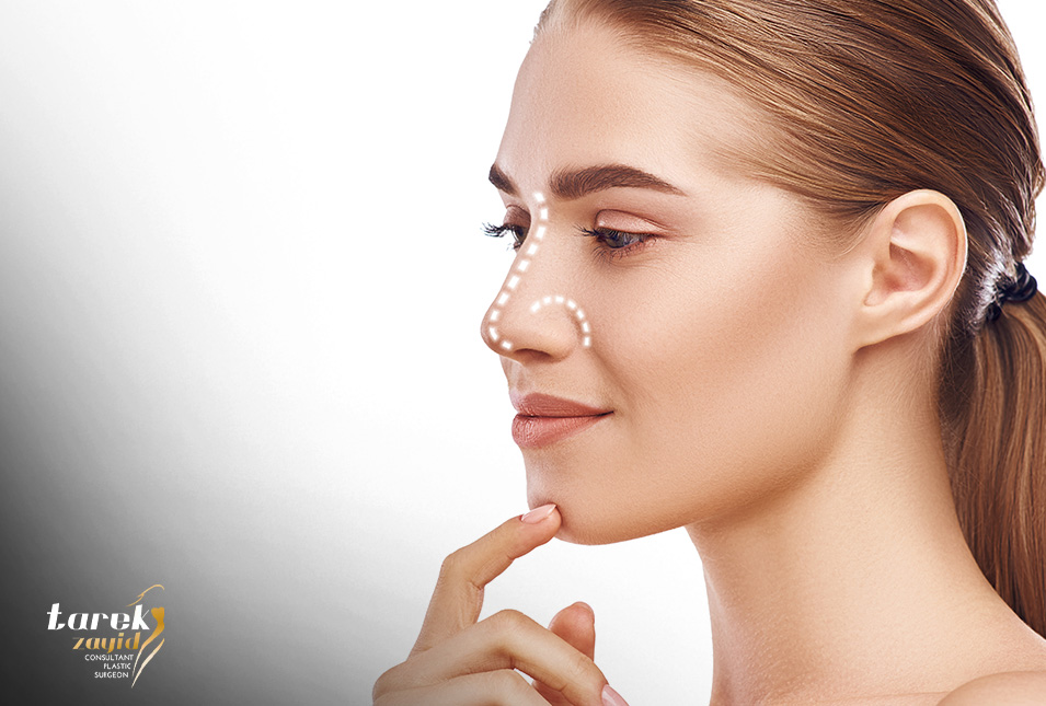 Rhinoplasty-Cost-in-Egypt
