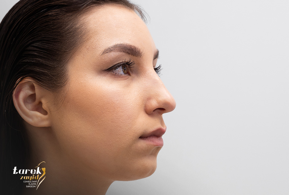 Rhinoplasty-Experiences-in-Egypt