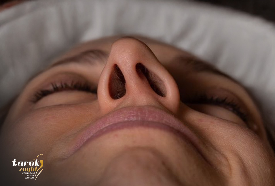 Tips-After-Septoplasty