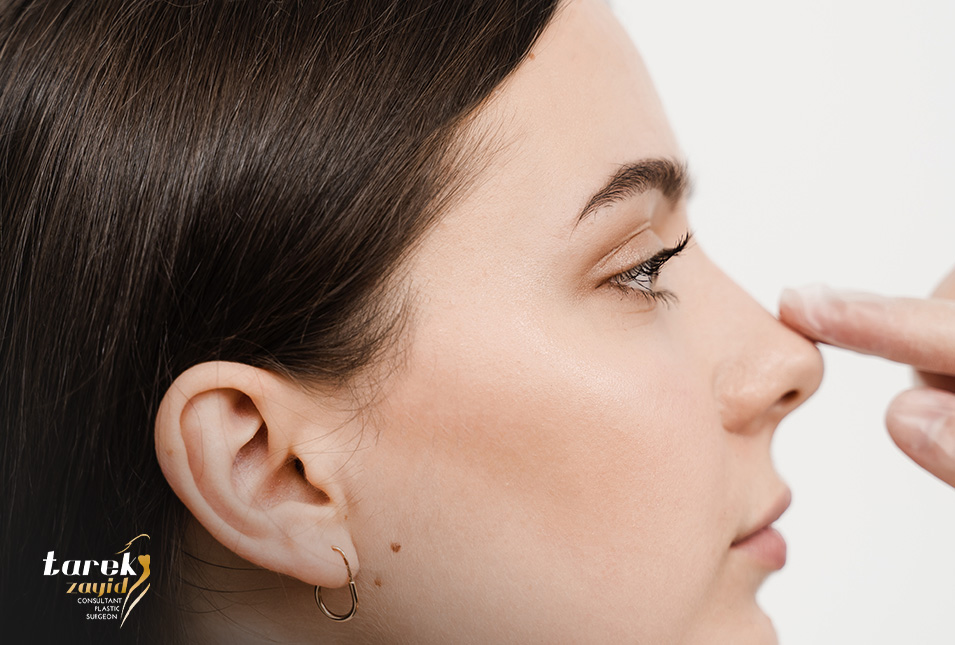 أنواع-عمليات-تجميل-الأنف