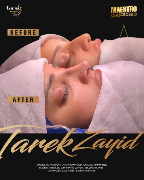 افضل دكتور تجميل انف في مصر 2026