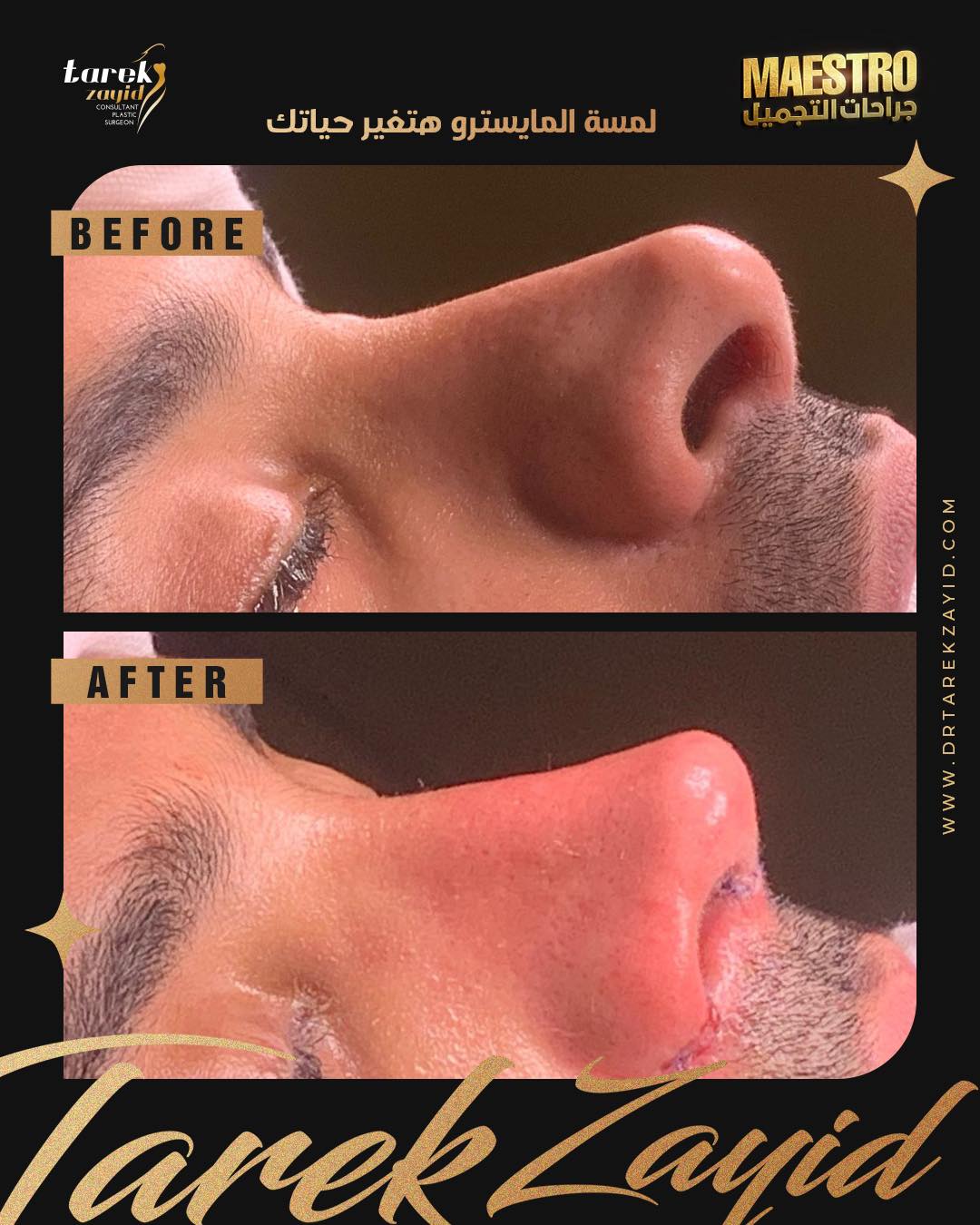 افضل دكتور تجميل انف في مصر