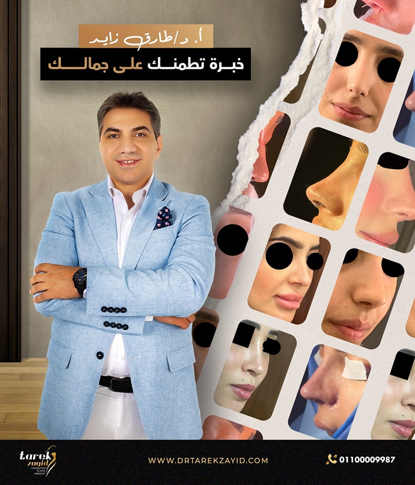 افضل دكتور تجميل انف في مصر 2026